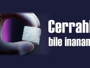 CERRAHLAR BİLE İNANAMADI!