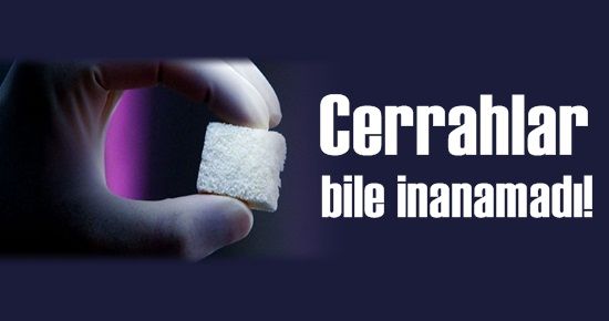 CERRAHLAR BİLE İNANAMADI!