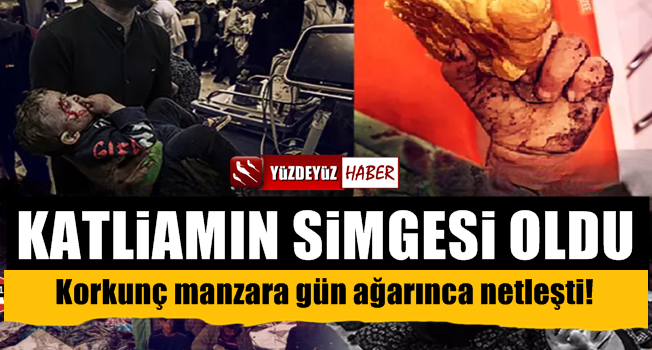 İsrail'in katliamı kahretti, Gazze katliamının boyutu gün yüzüne çıktı