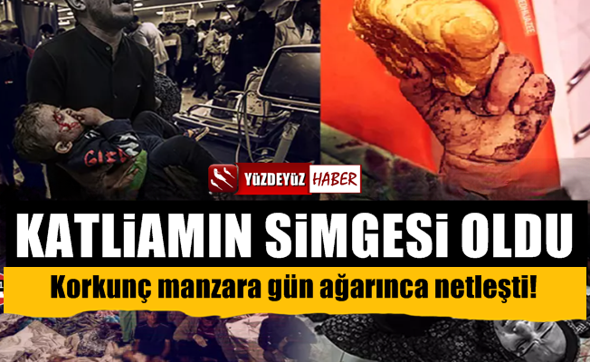 İsrail'in katliamı kahretti, Gazze katliamının boyutu gün yüzüne çıktı